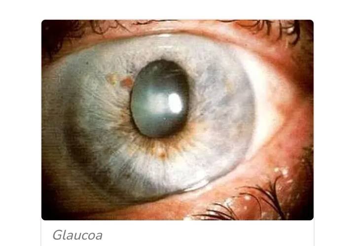 Topic Image
