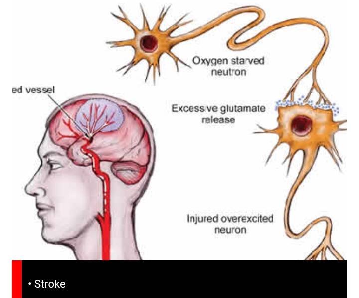 Topic Image